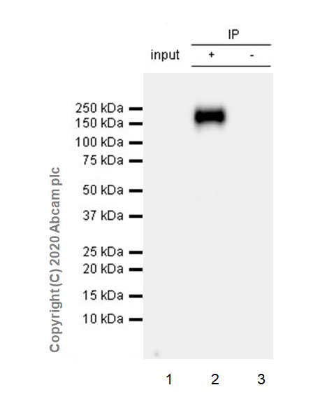 Immunoprecipitation - Anti-DCC antibody [EPR23313-115] (ab273570), expandable thumbnail