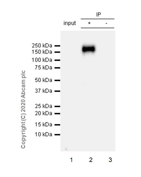Immunoprecipitation - Anti-DCC antibody [EPR23313-115] (AB273570)