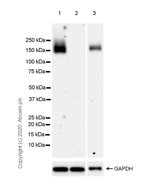 Western blot - Anti-DCC antibody [EPR23313-115] (AB273570), expandable thumbnail