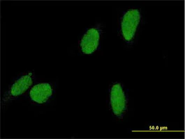 Immunocytochemistry/ Immunofluorescence - Anti-DCC1 antibody (AB168133)