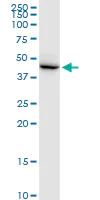 Western blot - Anti-DCC1 antibody (AB168133)
