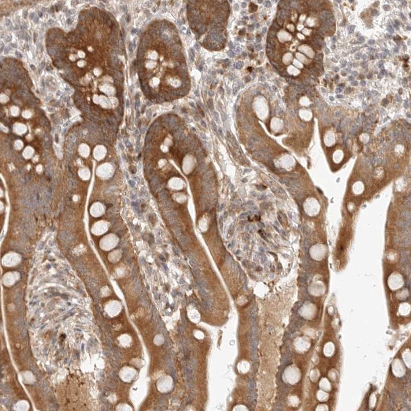 Immunohistochemistry (Formalin/PFA-fixed paraffin-embedded sections) - Anti-DCC1 antibody (AB254752)
