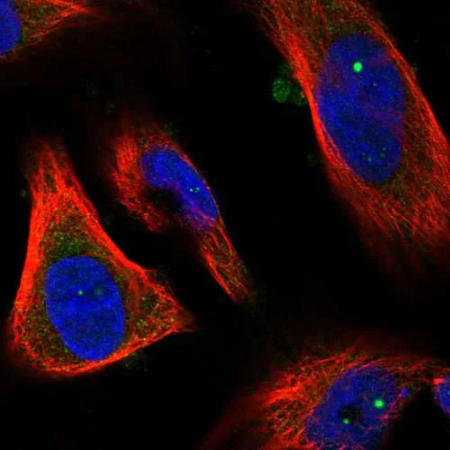 Immunocytochemistry/ Immunofluorescence - Anti-DCDC2C antibody (AB126564)