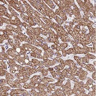 Immunohistochemistry (Formalin/PFA-fixed paraffin-embedded sections) - Anti-DCDC2C antibody (AB126564)