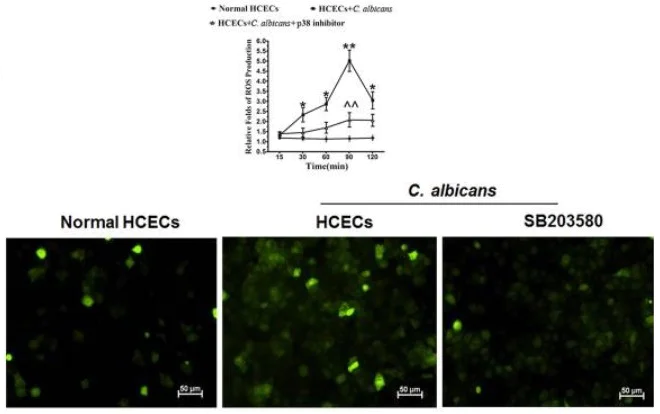 Fluorescence Microscopy - DCFDA / H2DCFDA - Cellular ROS Assay Kit (AB113851)
