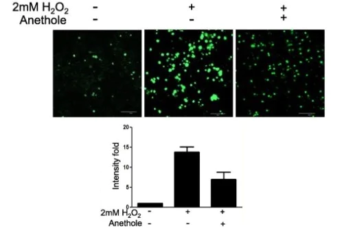 Fluorescence Microscopy - DCFDA / H2DCFDA - Cellular ROS Assay Kit (AB113851)