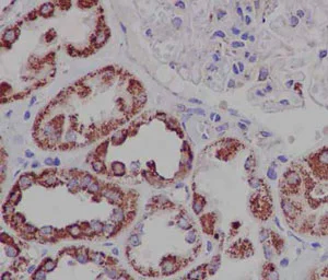 Immunohistochemistry (Formalin/PFA-fixed paraffin-embedded sections) - Anti-DCI antibody [EPR15375(B)] (AB186752)
