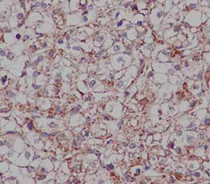 Immunohistochemistry (Formalin/PFA-fixed paraffin-embedded sections) - Anti-DCI antibody [EPR15375(B)] (AB186752)