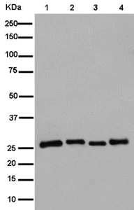 Western blot - Anti-DCI antibody [EPR15375(B)] (AB186752)