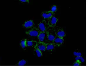 Immunocytochemistry/ Immunofluorescence - Anti-DCI antibody [EPR15375(B)] - BSA and Azide free (AB250903)