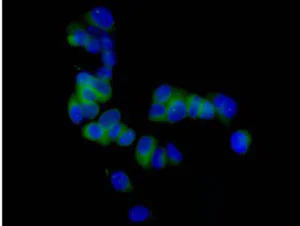 Immunocytochemistry/ Immunofluorescence - Anti-DCI antibody [EPR15375(B)] - BSA and Azide free (AB250903)