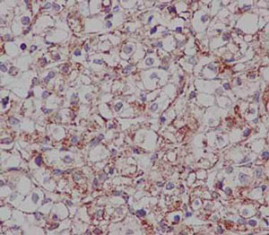 Immunohistochemistry (Formalin/PFA-fixed paraffin-embedded sections) - Anti-DCI antibody [EPR15375(B)] - BSA and Azide free (AB250903)
