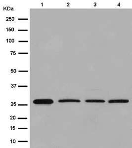 Western blot - Anti-DCI antibody [EPR15375(B)] - BSA and Azide free (AB250903)