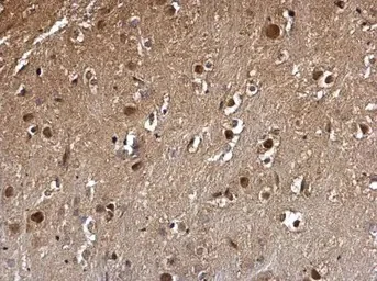 Immunohistochemistry (Formalin/PFA-fixed paraffin-embedded sections) - Anti-DCK antibody (AB151966)