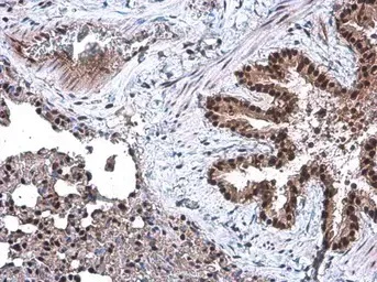 Immunohistochemistry (Formalin/PFA-fixed paraffin-embedded sections) - Anti-DCK antibody (AB151966)