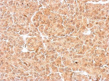 Immunohistochemistry (Formalin/PFA-fixed paraffin-embedded sections) - Anti-DCK antibody (AB151966), expandable thumbnail