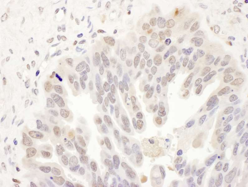 Immunohistochemistry (Formalin/PFA-fixed paraffin-embedded sections) - Anti-DCK antibody (AB186128)