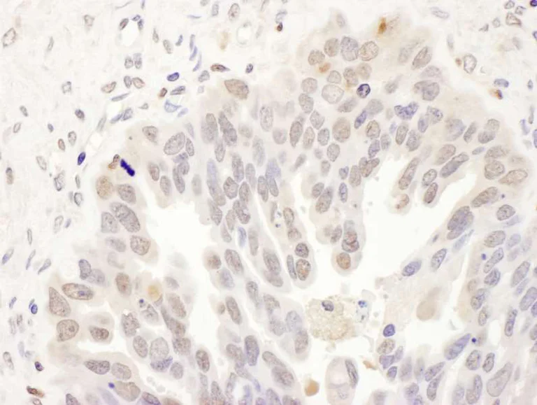 Immunohistochemistry (Formalin/PFA-fixed paraffin-embedded sections) - Anti-DCK antibody (AB186128)