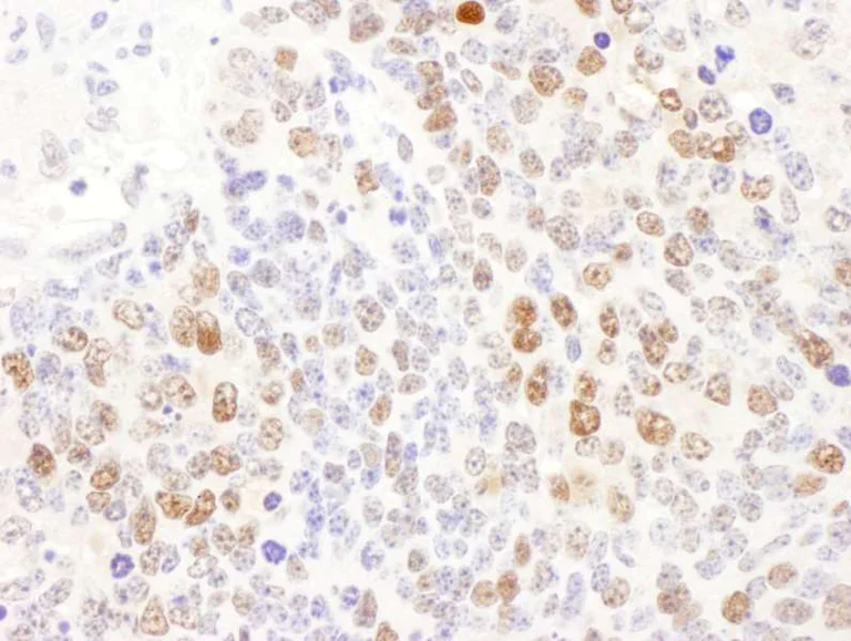 Immunohistochemistry (Formalin/PFA-fixed paraffin-embedded sections) - Anti-DCK antibody (AB186128)