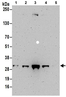 Western blot - Anti-DCK antibody (AB186128)