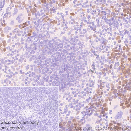 Immunohistochemistry (Formalin/PFA-fixed paraffin-embedded sections) - Anti-DCK antibody [EPR29105-53] (ab317829), expandable thumbnail