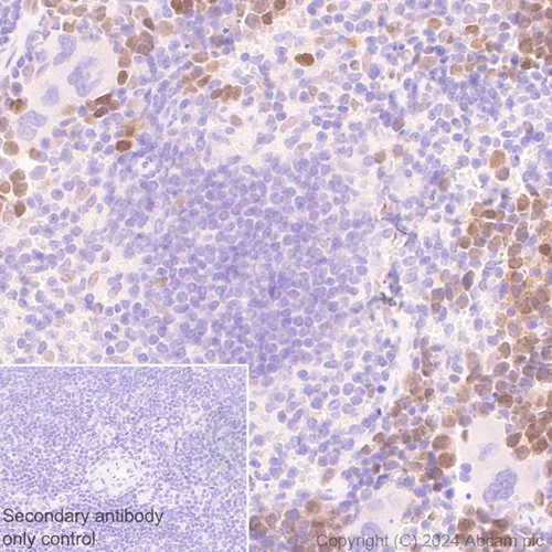 Immunohistochemistry (Formalin/PFA-fixed paraffin-embedded sections) - Anti-DCK antibody [EPR29105-53] (AB317829)
