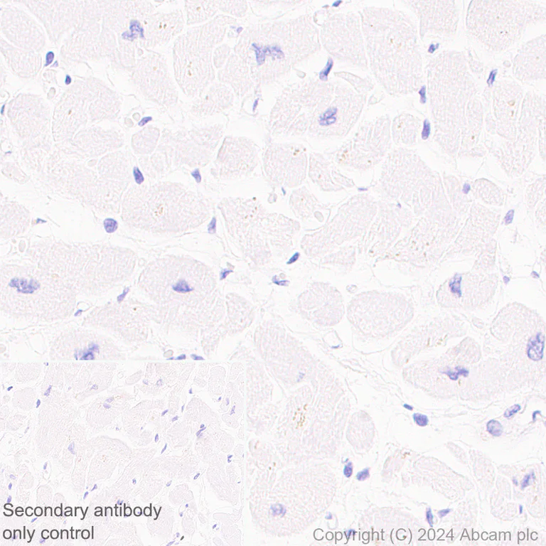 Immunohistochemistry (Formalin/PFA-fixed paraffin-embedded sections) - Anti-DCK antibody [EPR29105-53] (AB317829)