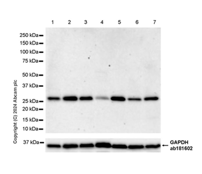 Western blot - Anti-DCK antibody [EPR29105-53] (AB317829), expandable thumbnail