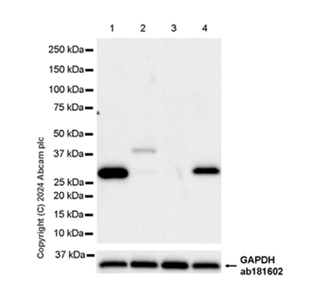 Western blot - Anti-DCK antibody [EPR29105-53] (AB317829), expandable thumbnail