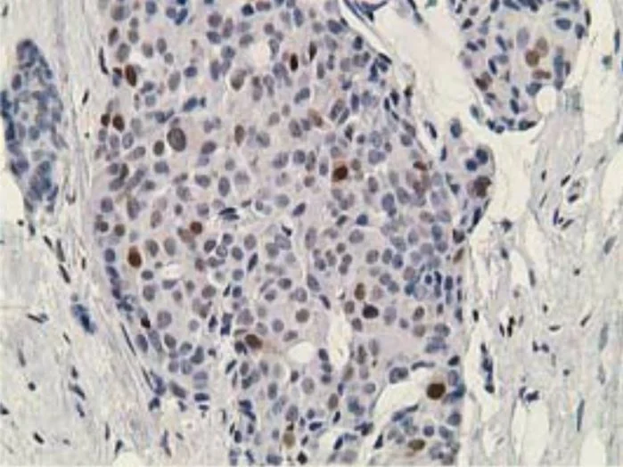 Immunohistochemistry (Formalin/PFA-fixed paraffin-embedded sections) - Anti-DCK antibody [OTI16G6] - BSA and Azide free (AB273650)