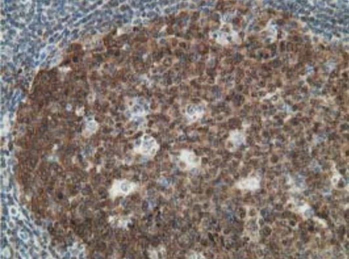 Immunohistochemistry (Formalin/PFA-fixed paraffin-embedded sections) - Anti-DCK antibody [OTI16G6] - BSA and Azide free (AB273650)