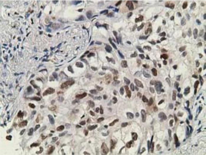 Immunohistochemistry (Formalin/PFA-fixed paraffin-embedded sections) - Anti-DCK antibody [OTI16G6] - BSA and Azide free (AB273650)