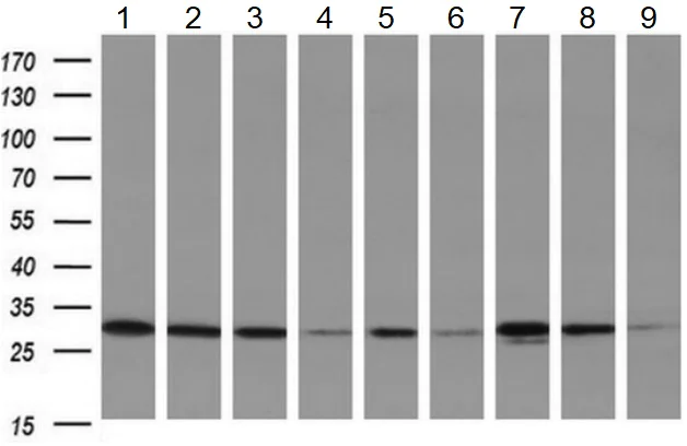 Western blot - Anti-DCK antibody [OTI16G6] - BSA and Azide free (AB273650)