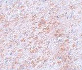 Immunohistochemistry (Formalin/PFA-fixed paraffin-embedded sections) - Anti-DCLK2 antibody (AB106639)