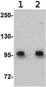 Western blot - Anti-DCLK2 antibody (AB106639)
