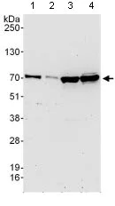Western blot - Anti-Dcp1a antibody (AB128156)