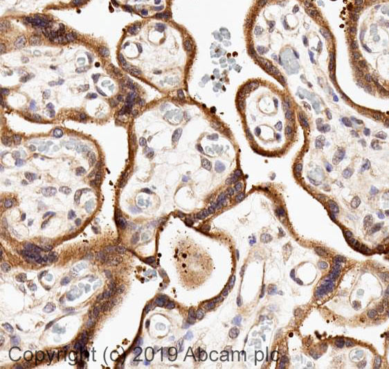 Immunohistochemistry (Formalin/PFA-fixed paraffin-embedded sections) - Anti-Dcp1a antibody (AB47811)