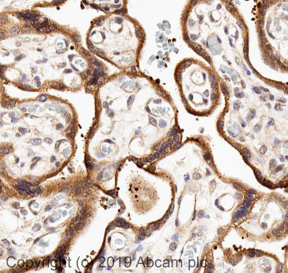 Immunohistochemistry (Formalin/PFA-fixed paraffin-embedded sections) - Anti-Dcp1a antibody (AB47811)