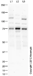 Western blot - Anti-Dcp1a antibody (AB47811)