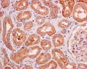 Immunohistochemistry (Formalin/PFA-fixed paraffin-embedded sections) - Anti-Dcp1a antibody [EPR13822] (AB183709)