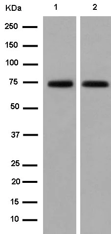 Western blot - Anti-Dcp1a antibody [EPR13822] (AB183709)