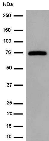 Western blot - Anti-Dcp1a antibody [EPR13822] (AB183709)