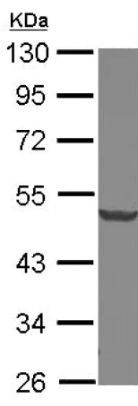 Western blot - Anti-Dcp2/TDT antibody (AB127185)