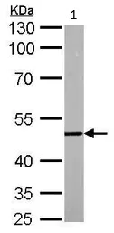 Western blot - Anti-Dcp2/TDT antibody (AB127185)