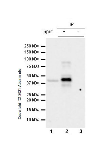 Immunoprecipitation - Anti-Dcp2/TDT antibody [EPR25378-93] (AB288158), expandable thumbnail