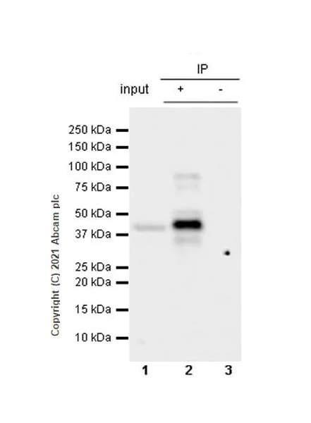 Immunoprecipitation - Anti-Dcp2/TDT antibody [EPR25378-93] (AB288158)