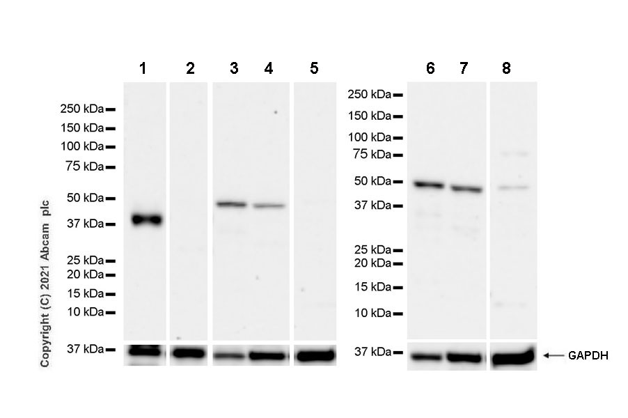 Western blot - Anti-Dcp2/TDT antibody [EPR25378-93] (AB288158), expandable thumbnail