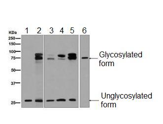 Western blot - Anti-DcR1 antibody [EPR6162] (AB133658)