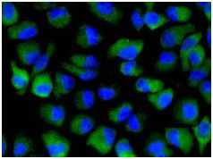 Immunocytochemistry/ Immunofluorescence - Anti-DcR1 antibody [EPR6162] - BSA and Azide free (AB248600)
