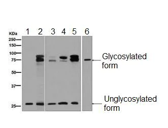 Western blot - Anti-DcR1 antibody [EPR6162] - BSA and Azide free (AB248600)